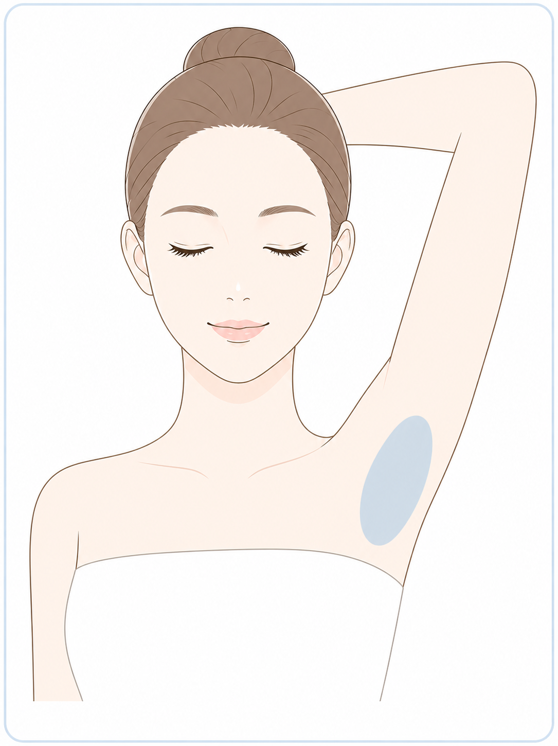 多汗症・ワキ汗のボトックス治療イラスト