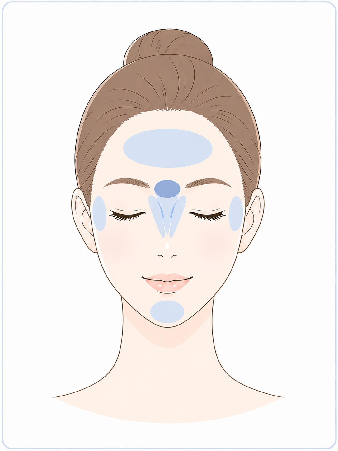 表情じわのボトックス施術部位イラスト