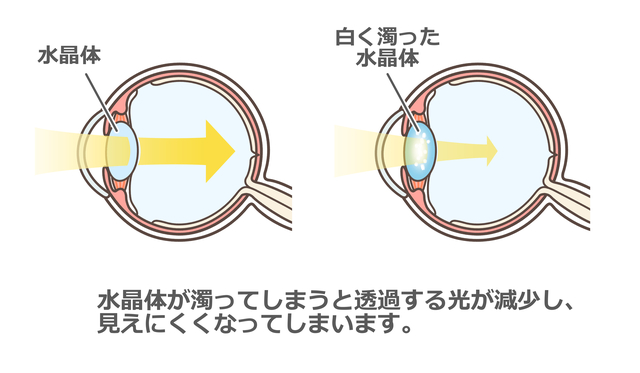 水晶体